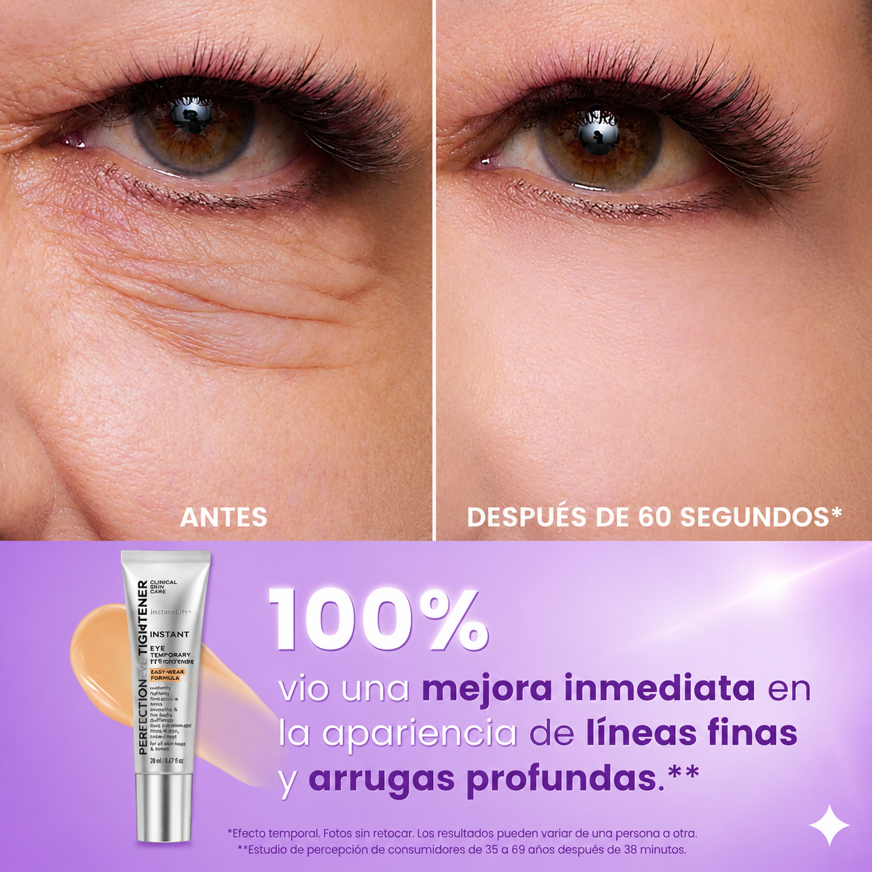 Tratamiento Lifting de ojos™ - Despidetede de las Arrugas