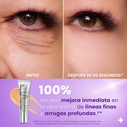 Tratamiento Lifting de ojos™ - Despidetede de las Arrugas