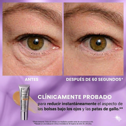 Tratamiento Lifting de ojos™ - Despidetede de las Arrugas
